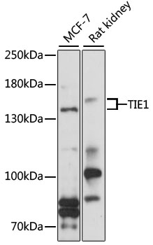 Anti-TIE1 Antibody (CAB3334)