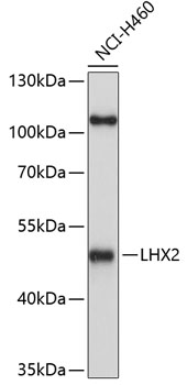 Anti-LHX2 Antibody (CAB10803)