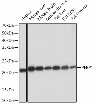 Anti-PEBP1 Antibody