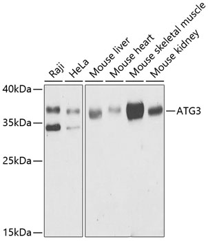 Anti-ATG3 Antibody (CAB5809)