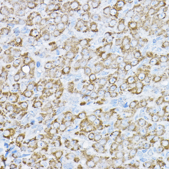 Anti-UBE2F Antibody (CAB5160)