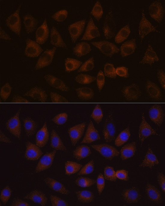 Anti-HDLBP Antibody (CAB6028)