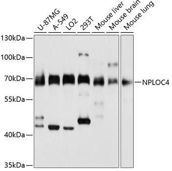 Anti-NPLOC4 Antibody (CAB3256)