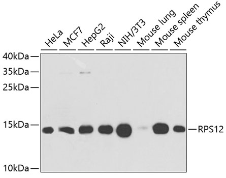 Anti-RPS12 Antibody (CAB5890)