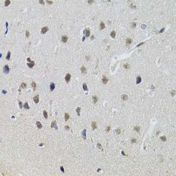 Anti-STAT1 Antibody (CAB0027)