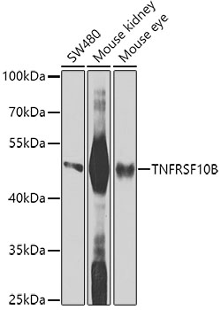 Anti-TNFRSF10B Monoclonal Antibody (CAB9914)