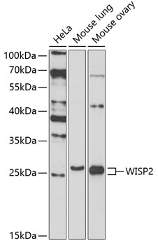 Anti-WISP2 Antibody (CAB7456)