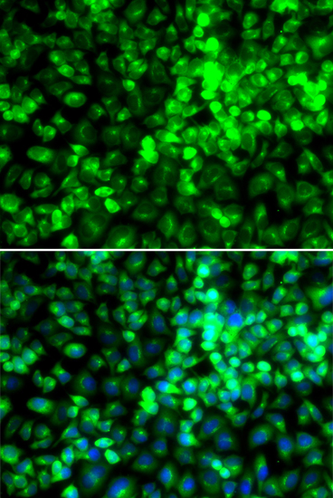 Anti-EIF2AK4 Antibody (CAB12618)