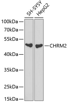 Anti-CHRM2 Antibody (CAB1567)