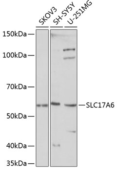 Anti-SLC17A6 Antibody (CAB15177)