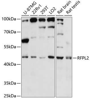 Anti-RFPL2 Antibody (CAB14604)