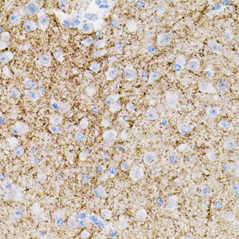 Anti-NTF3 Antibody (CAB12476)