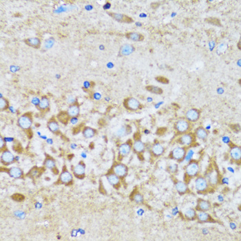 Anti-ACTR2 Antibody (CAB5734)