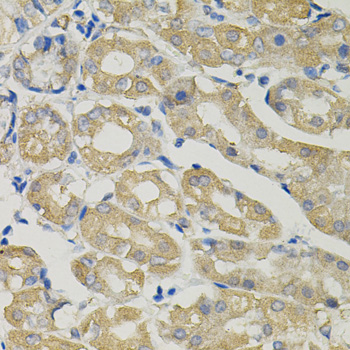 Anti-Zinc transporter 1 Polyclonal Antibody (CAB9954)