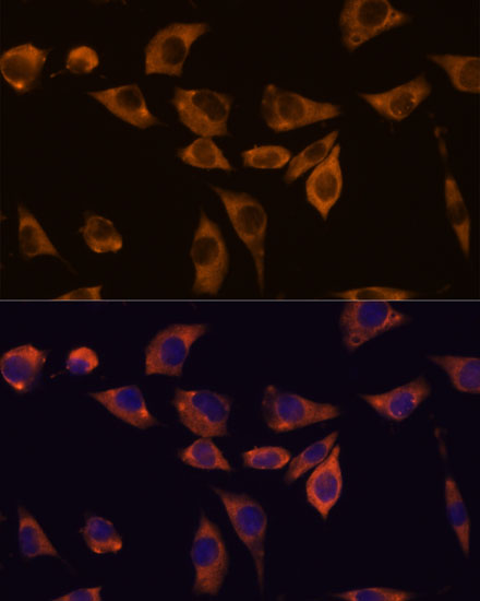 Anti-IL-10RB Antibody (CAB15680)