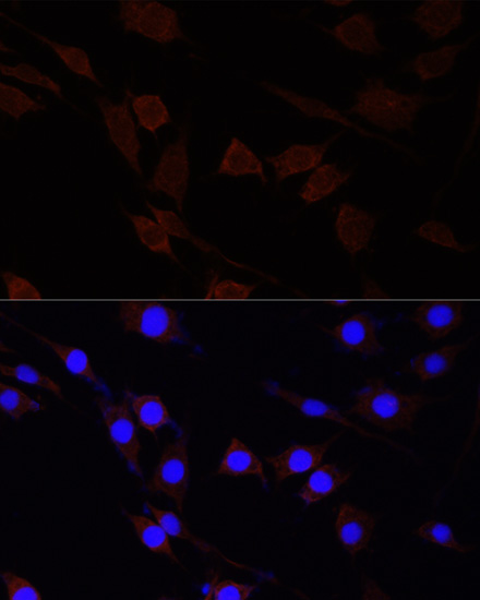 Anti-SERPINA10 Antibody (CAB7106)