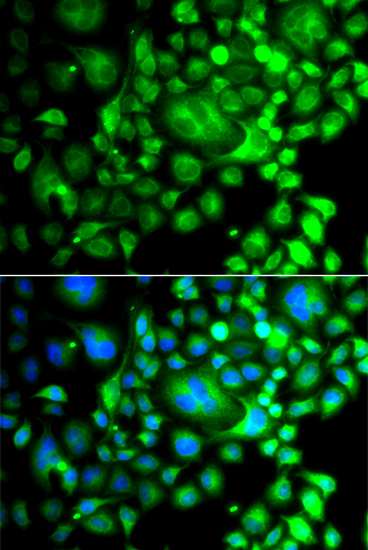 Anti-SNX3 Antibody (CAB13380)