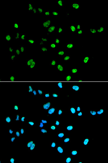 Anti-PAX2 Antibody (CAB3067)