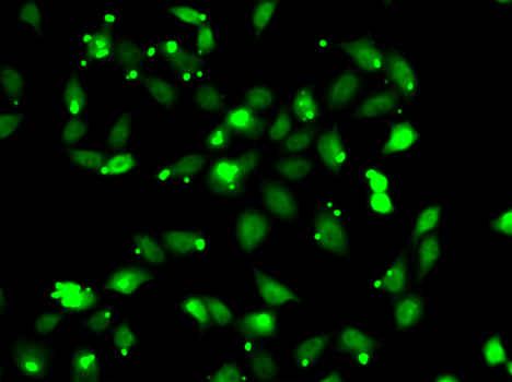 Anti-C1S Antibody (CAB13675)