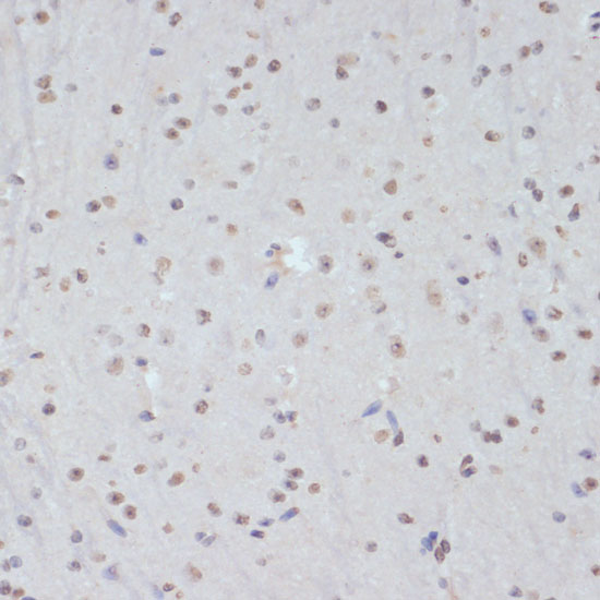 Anti-Phospho-CDK1-Y15 Antibody (CABP0016)