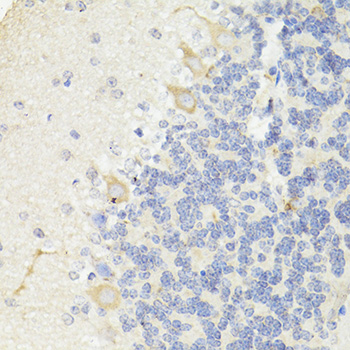 Anti-APP Antibody (CAB16265)