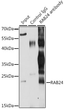Anti-RAB24 Polyclonal Antibody (CAB8394)