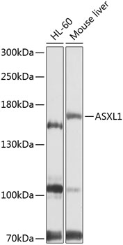 Anti-ASXL1 Polyclonal Antibody (CAB9890)