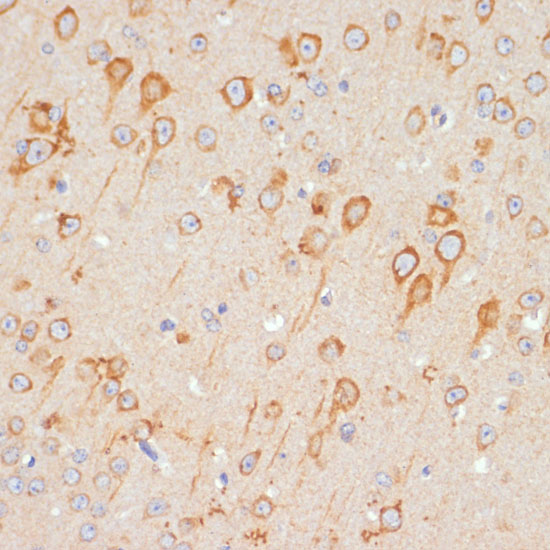 Anti-GRIA1 Antibody (CAB1826)