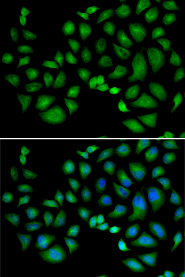 Anti-CLIC1 Antibody (CAB6363)