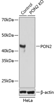 Anti-PON2 Antibody [KO Validated] (CAB19852)