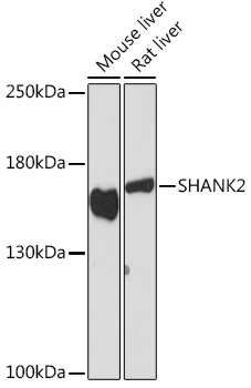 Anti-SHANK2 Antibody (CAB18423)