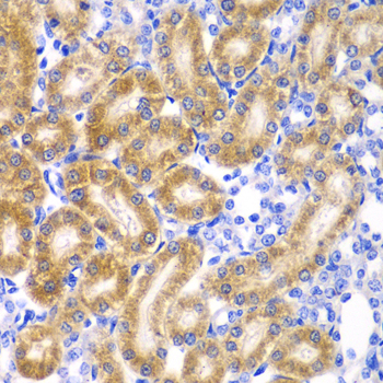 Anti-RPN1 Antibody (CAB6726)