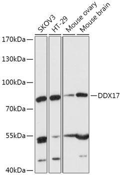 Anti-DDX17 Antibody (CAB17078)