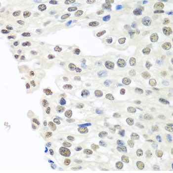 Anti-TARDBP Antibody (CAB13405)