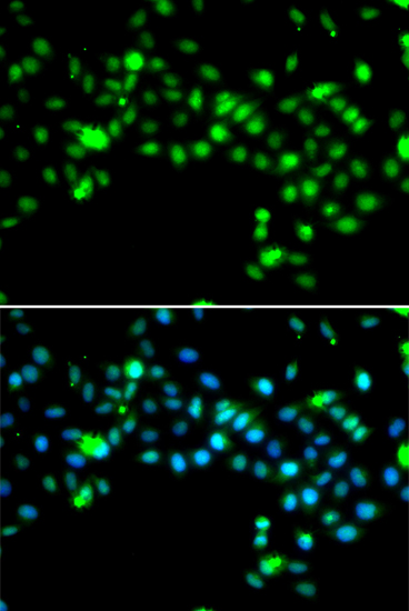 Anti-SRSF4 Antibody (CAB6978)