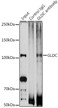 Anti-GLDC Polyclonal Antibody (CAB9933)