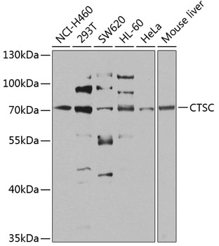 Anti-CTSC Polyclonal Antibody (CAB8403)