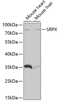 Anti-SRPX Antibody (CAB1217)