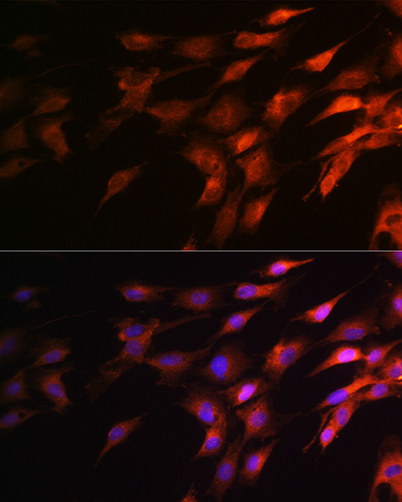 Anti-NEFH Polyclonal Antibody (CAB8442)