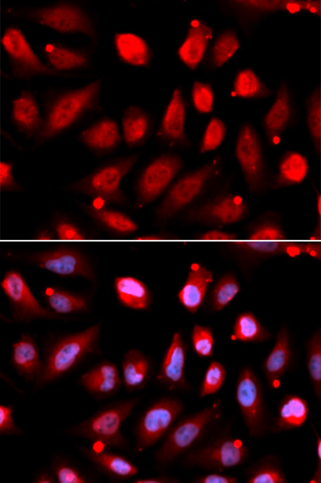 Anti-EZH2 Antibody [KO Validated] (CAB11085)