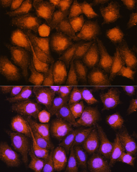 Anti-ASNA1 Antibody (CAB3746)