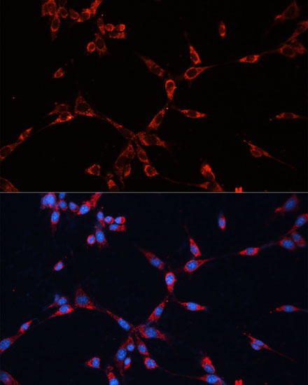 Anti-GNAI2 Antibody (CAB14547)