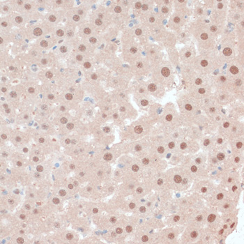 Anti-ZNF562 Antibody (CAB14901)