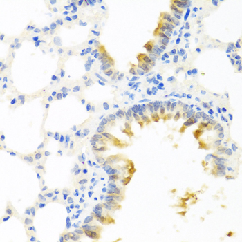 Anti-KLK11 Antibody (CAB12565)