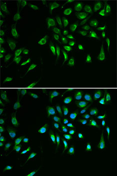 Anti-BIRC7 Antibody (CAB12600)