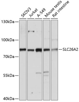 Anti-SLC26A2 Antibody (CAB14561)