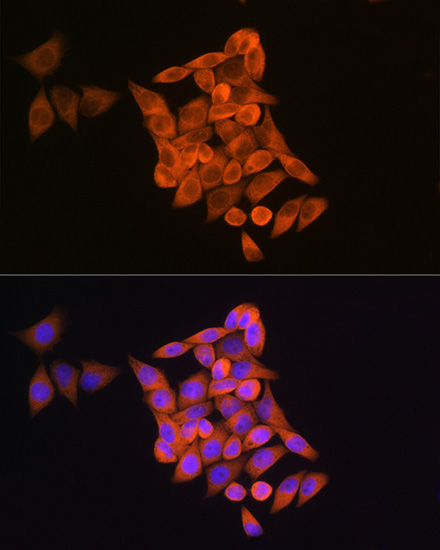 Anti-RRM1 Antibody (CAB13348)