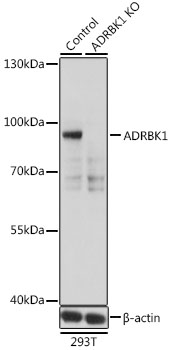 Anti-ADRBK1 Antibody [KO Validated] (CAB1662)