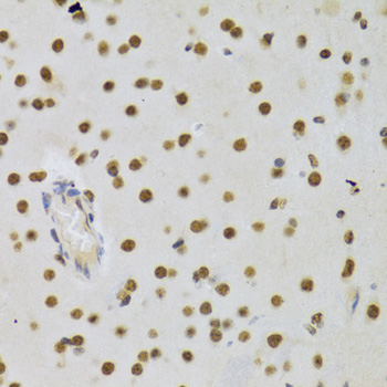 Anti-DNMT3A Antibody (CAB3169)