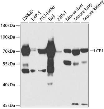 Anti-LCP1 Antibody (CAB13504)